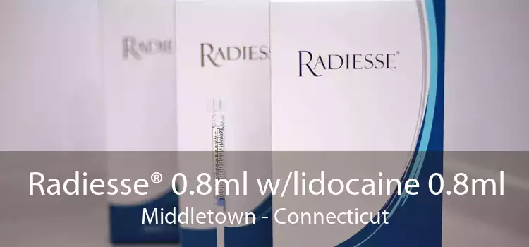Radiesse® 0.8ml w/lidocaine 0.8ml Middletown - Connecticut