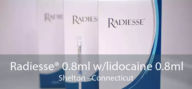 Radiesse® 0.8ml w/lidocaine 0.8ml Shelton - Connecticut